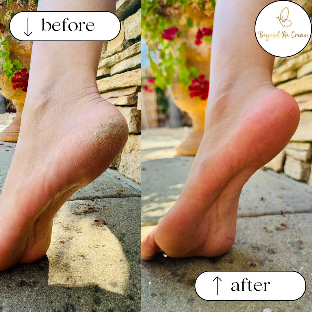 Foot Fetish File